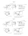 ZENITH PASSAGE PLUGS MODEL B 1932-34